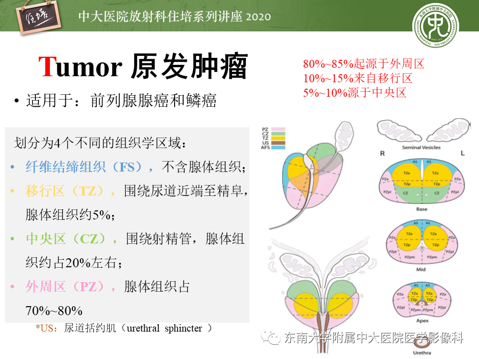 【PPT】MRI在前列腺癌TNM分期中的应用