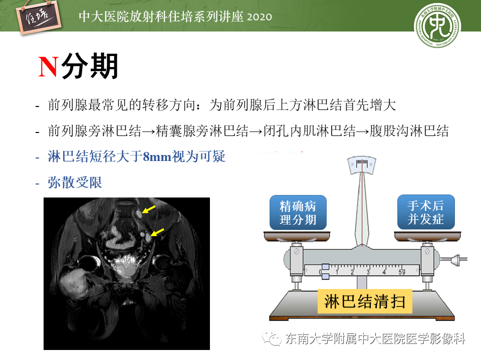 【PPT】MRI在前列腺癌TNM分期中的应用