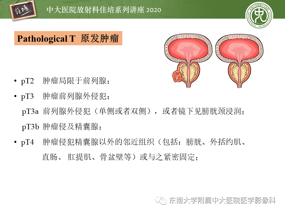 【PPT】MRI在前列腺癌TNM分期中的应用