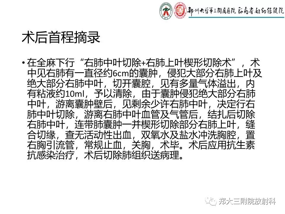 【PPT】先天性肺囊性腺瘤样畸形的影像诊断