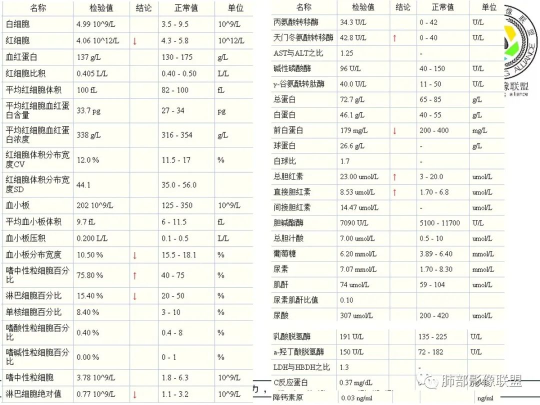【病例】让人琢磨不透的肺肿块—肺癌1例CT影像