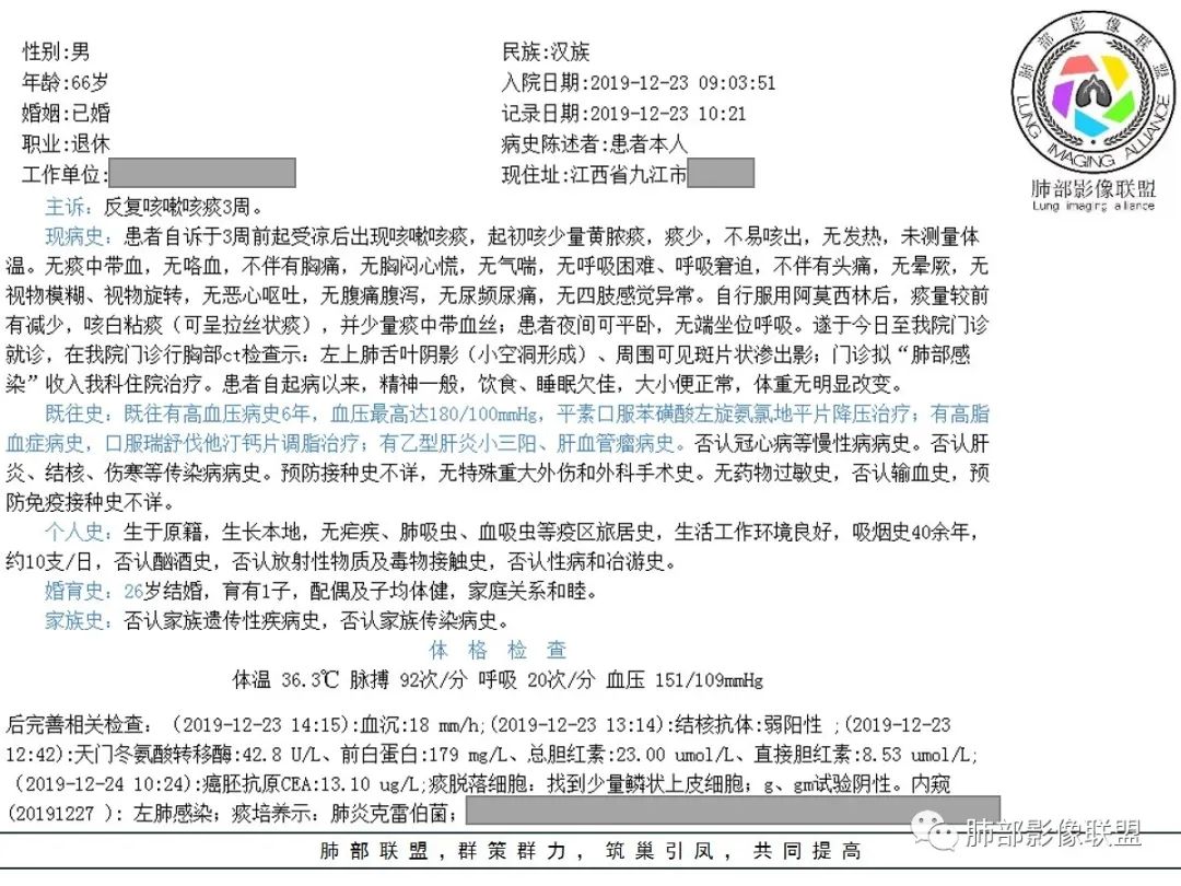 【病例】让人琢磨不透的肺肿块—肺癌1例CT影像