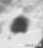 【病例】让人琢磨不透的肺肿块—肺癌1例CT影像