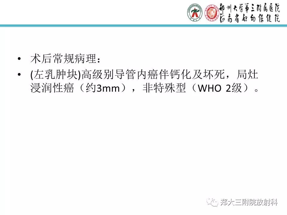 【PPT】乳腺导管内癌的X线表现