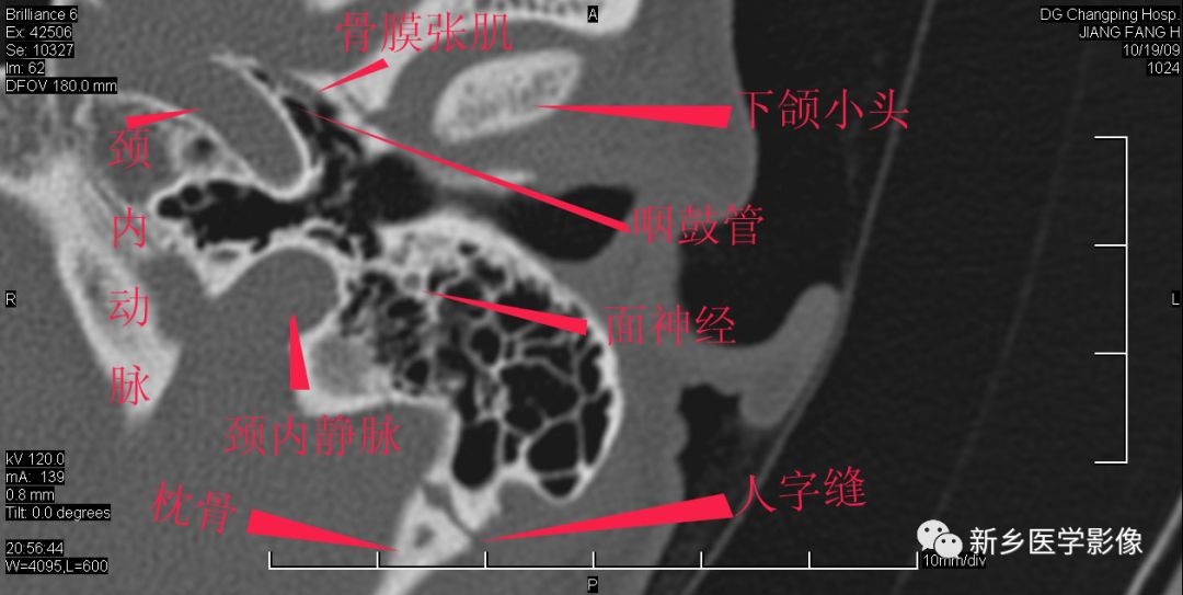 耳部详细解剖纯手工标注