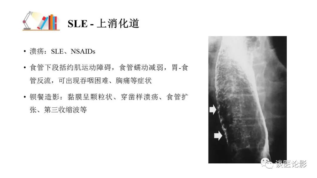 【PPT】 系统性红斑狼疮（SLE）的腹部影像表现