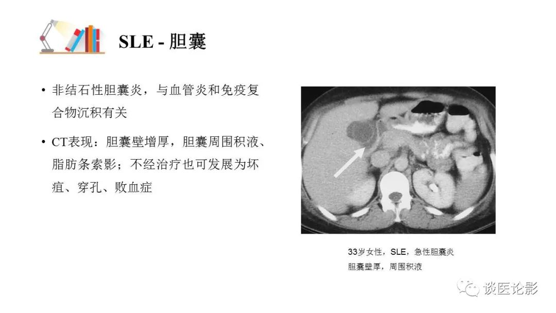 【PPT】 系统性红斑狼疮（SLE）的腹部影像表现