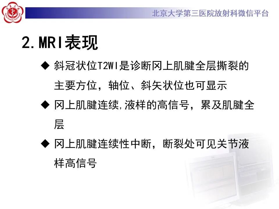 【PPT】慢性肩袖巨大撕裂的MR诊断