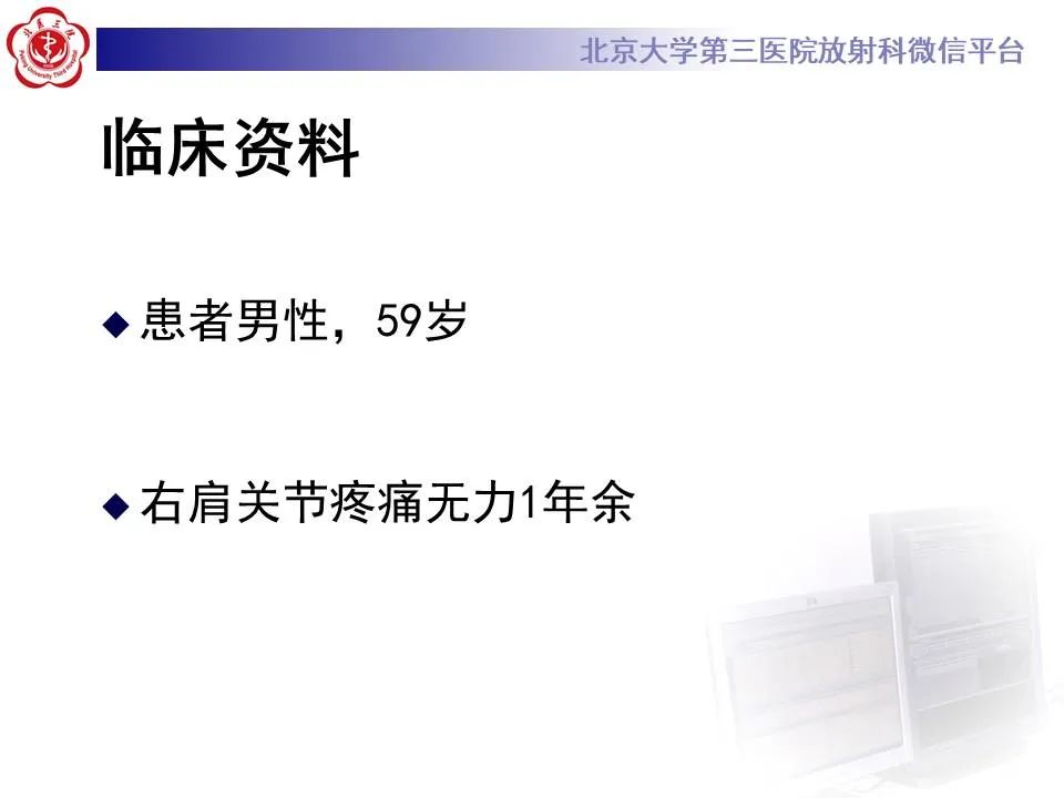 【PPT】慢性肩袖巨大撕裂的MR诊断