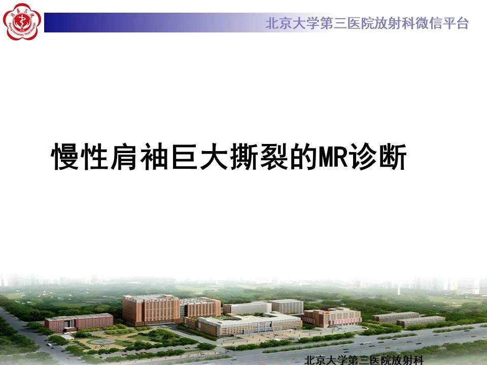 【PPT】慢性肩袖巨大撕裂的MR诊断