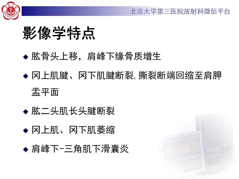 【PPT】慢性肩袖巨大撕裂的MR诊断