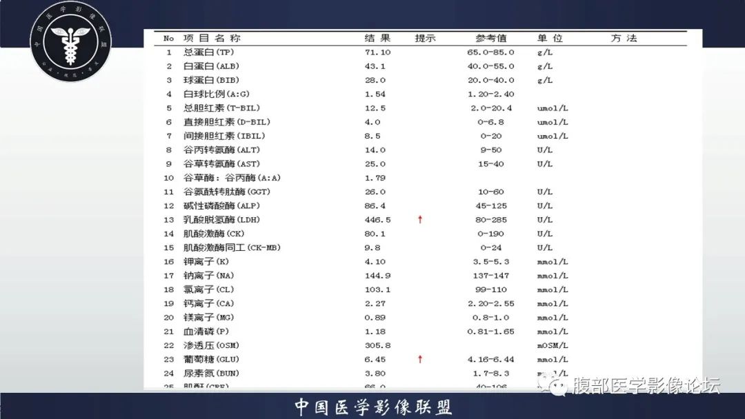 【病例】脾脏弥漫性大B细胞淋巴瘤1例MR影像讨论