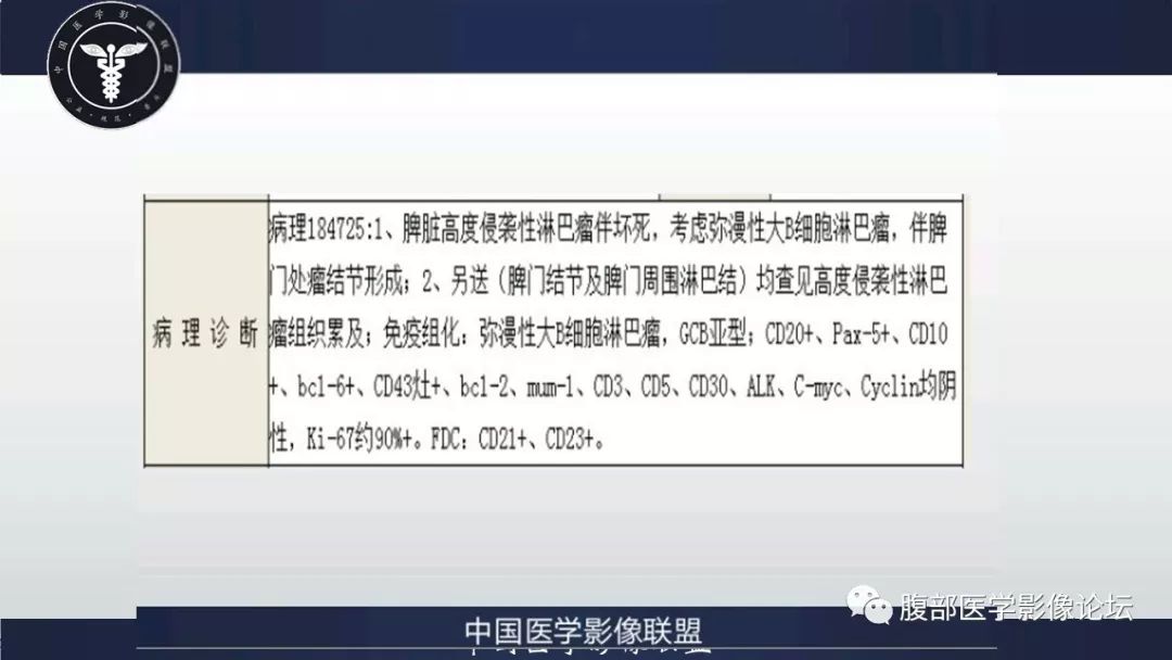 【病例】脾脏弥漫性大B细胞淋巴瘤1例MR影像讨论