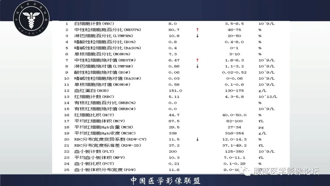 【病例】脾脏弥漫性大B细胞淋巴瘤1例MR影像讨论