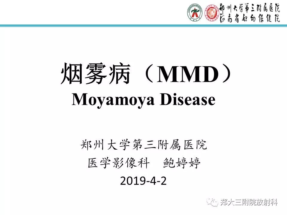 【PPT】烟雾病的影像诊断