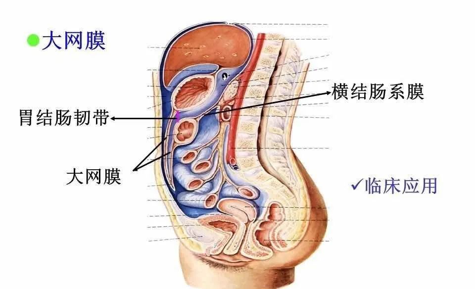 腹腔局灶性脂肪坏死的典型影像学征象及其鉴别诊断