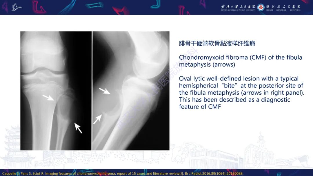 【PPT】