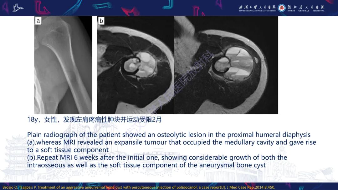 【PPT】