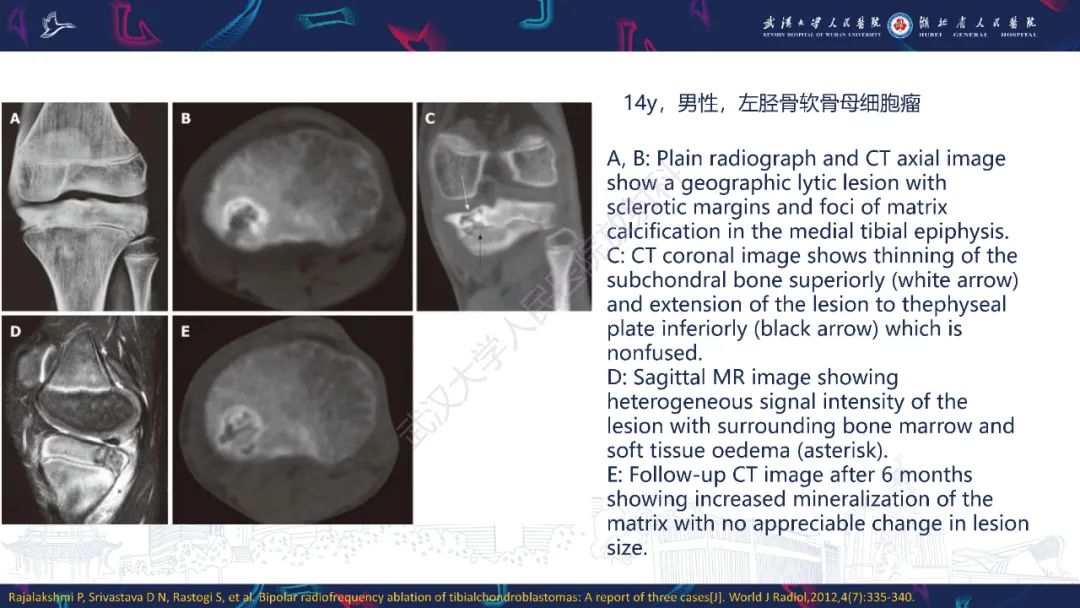 【PPT】