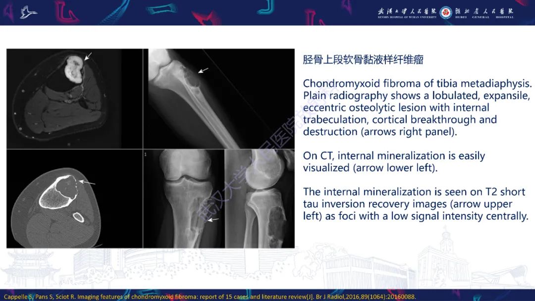 【PPT】