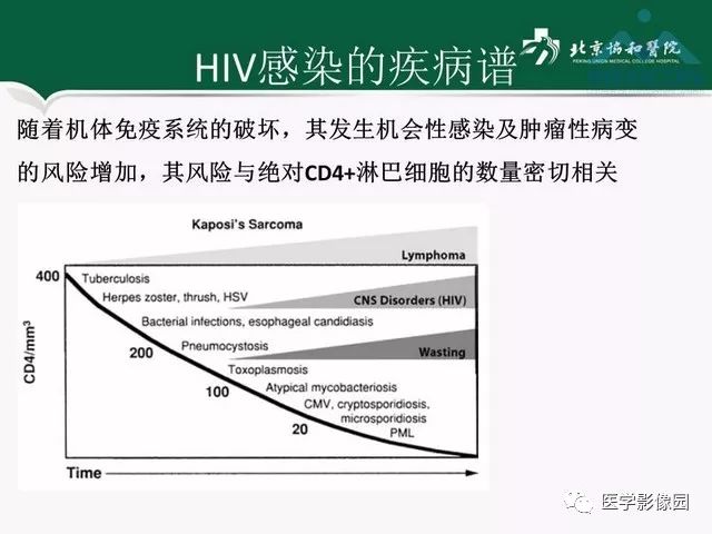 【PPT】艾滋病相关消化道影像学表现