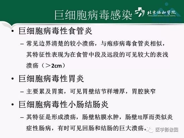 【PPT】艾滋病相关消化道影像学表现