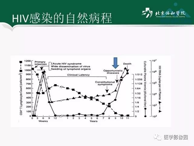 【PPT】艾滋病相关消化道影像学表现