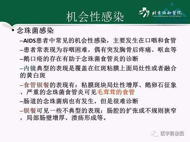 【PPT】艾滋病相关消化道影像学表现