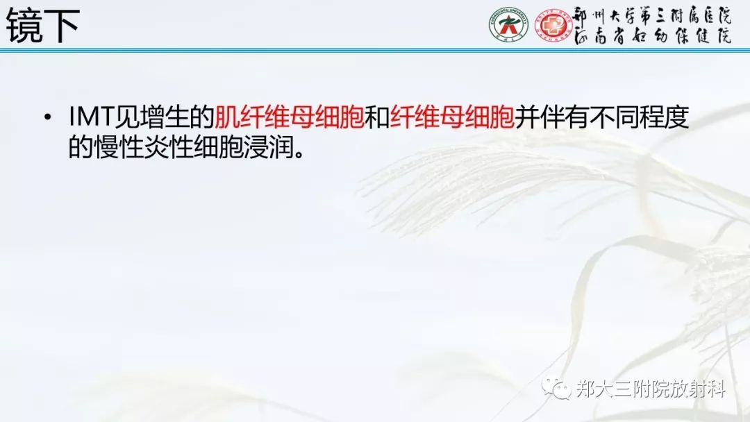 【PPT】炎性肌纤维母细胞瘤的影像表现 【PPT】炎性肌纤维母细胞瘤的影像表现