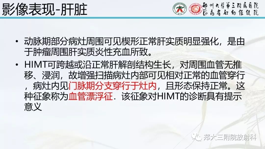 【PPT】炎性肌纤维母细胞瘤的影像表现 【PPT】炎性肌纤维母细胞瘤的影像表现