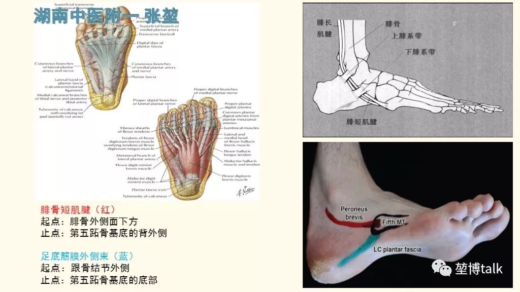 【PPT】第五跖骨基底骨折—你真的懂吗？