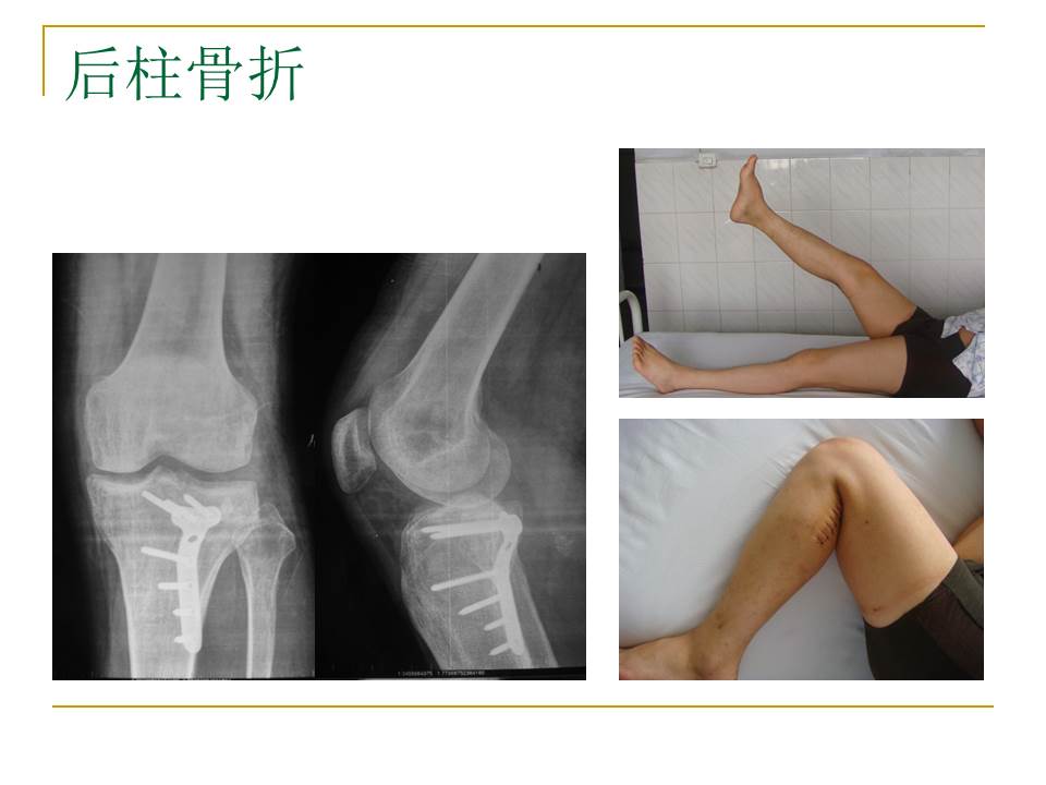 幻灯片20