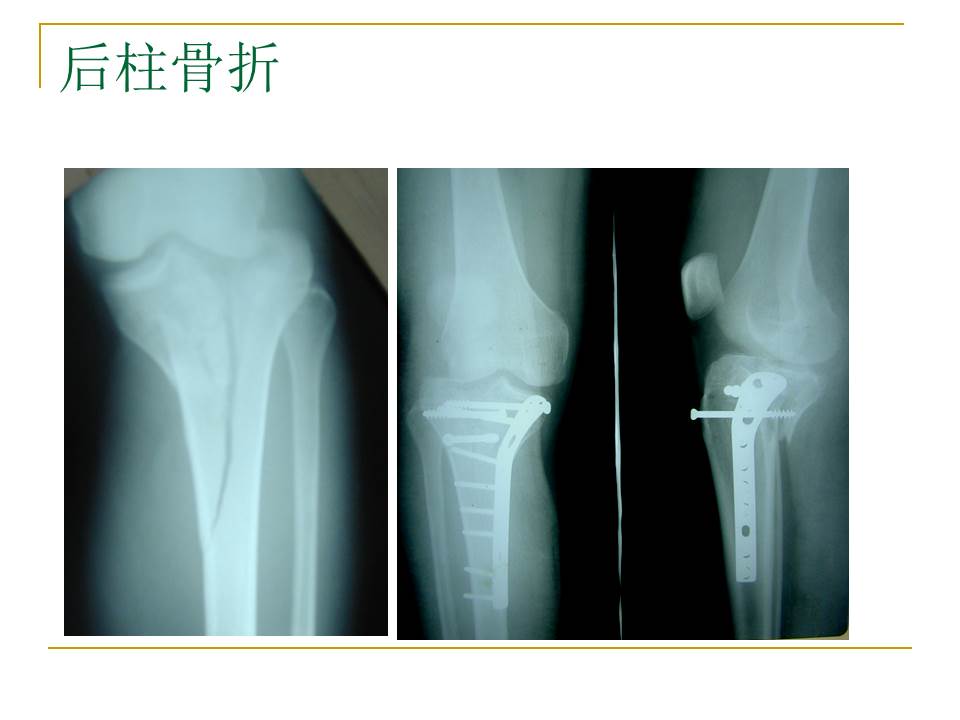 幻灯片16