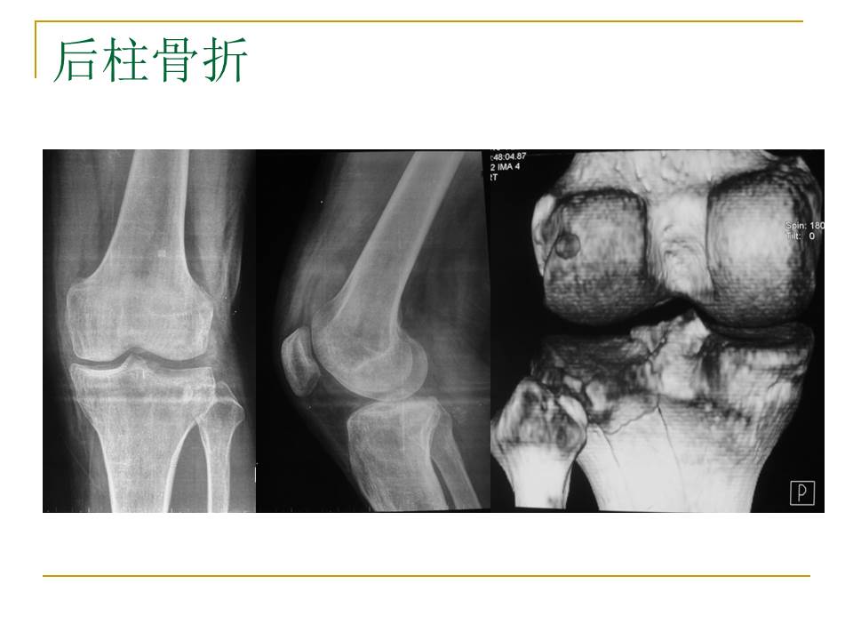 幻灯片19