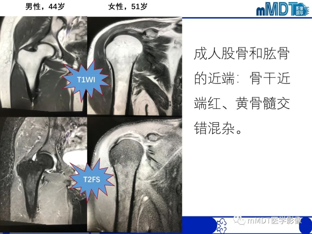 【PPT】骨髓的转化与逆转化