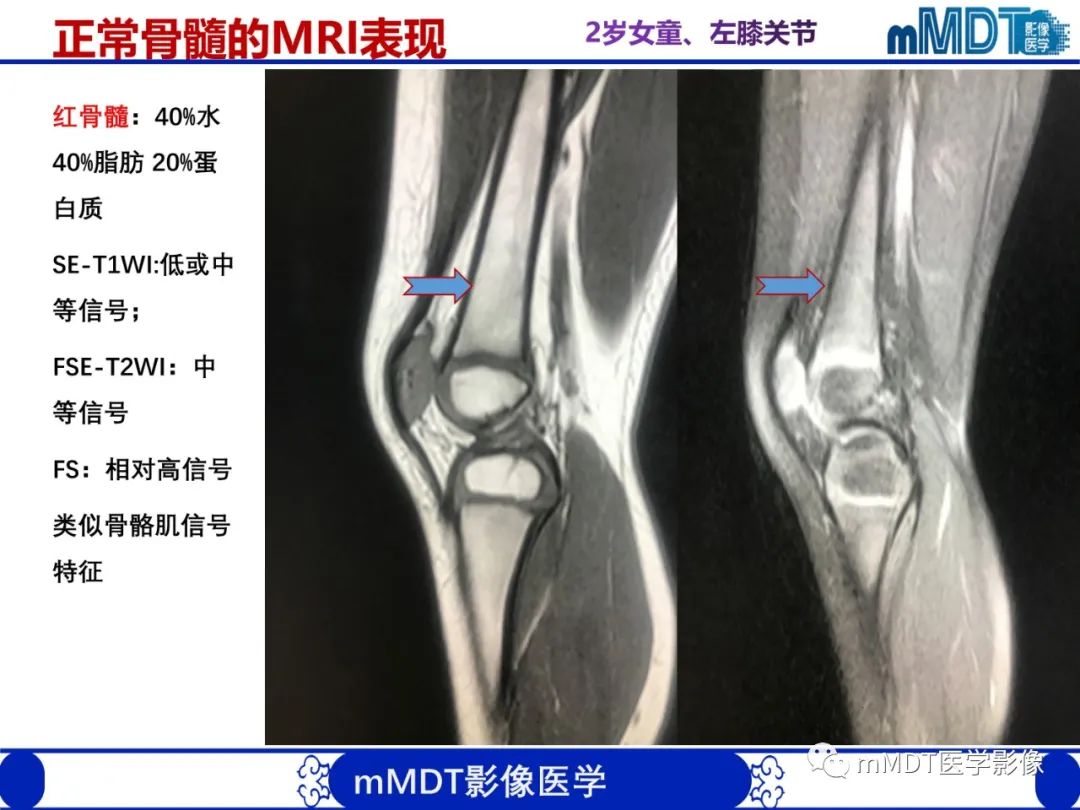 【PPT】骨髓的转化与逆转化