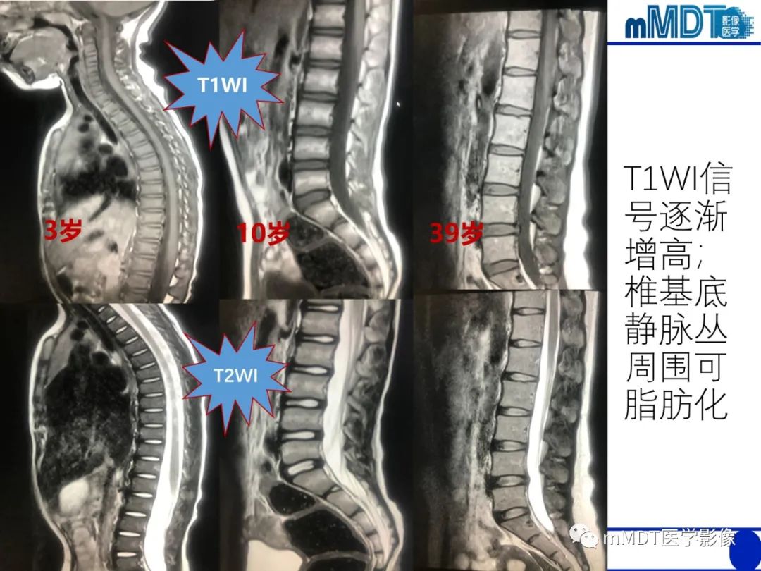 【PPT】骨髓的转化与逆转化
