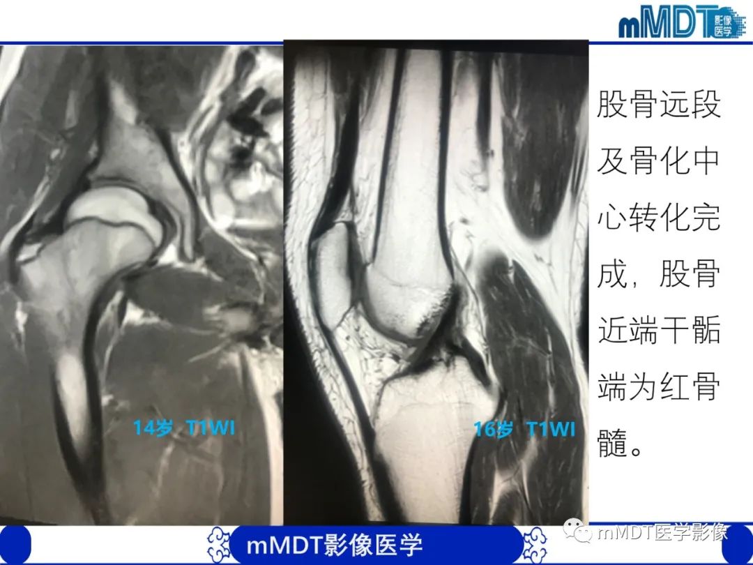 【PPT】骨髓的转化与逆转化