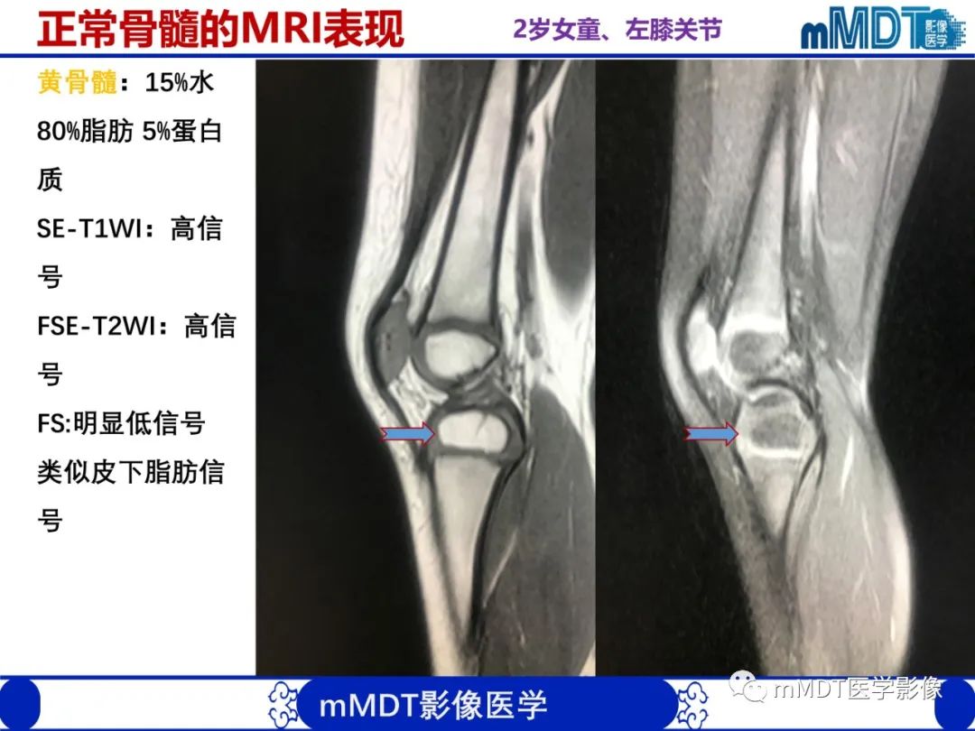 【PPT】骨髓的转化与逆转化