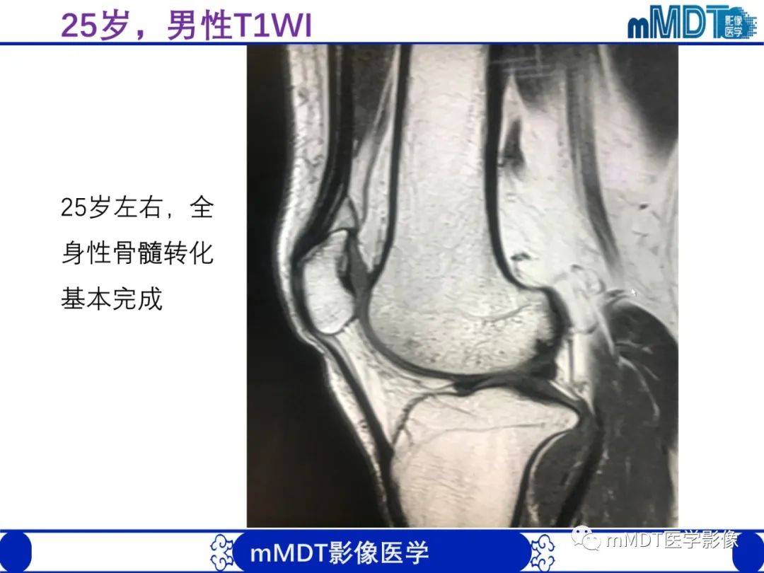 【PPT】骨髓的转化与逆转化