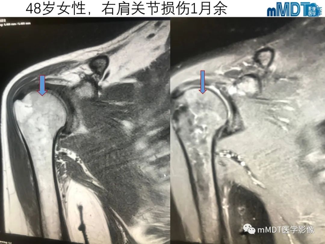 【PPT】骨髓的转化与逆转化
