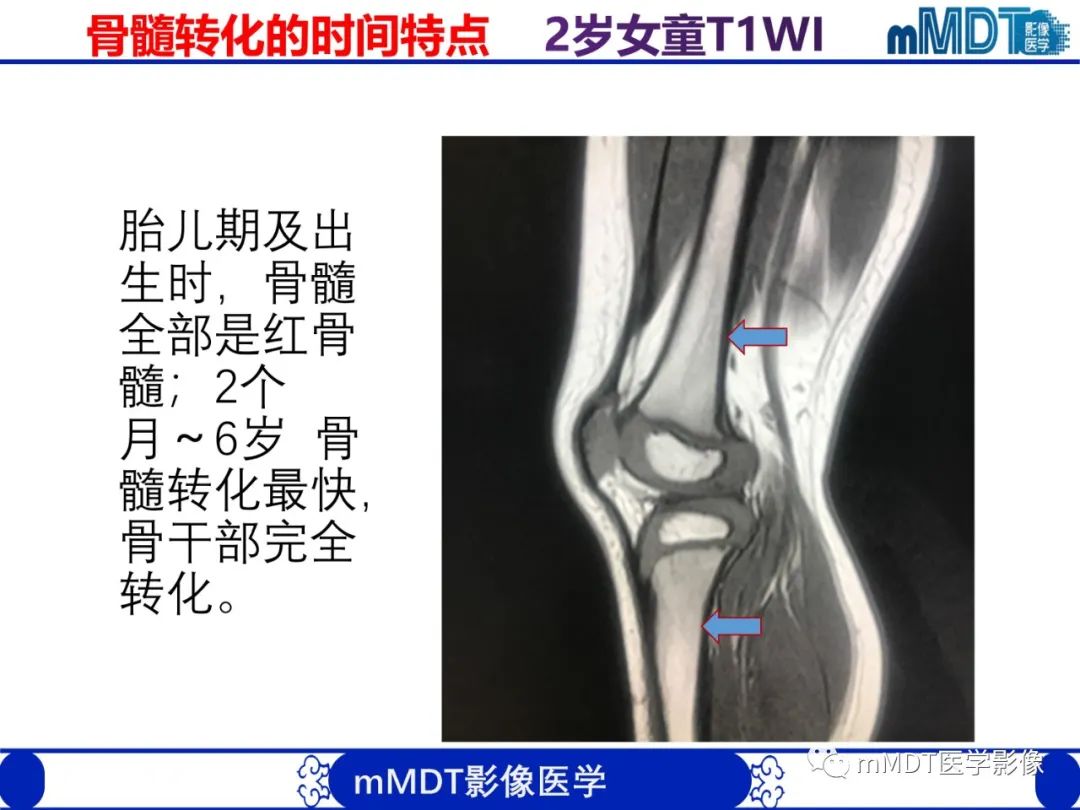 【PPT】骨髓的转化与逆转化