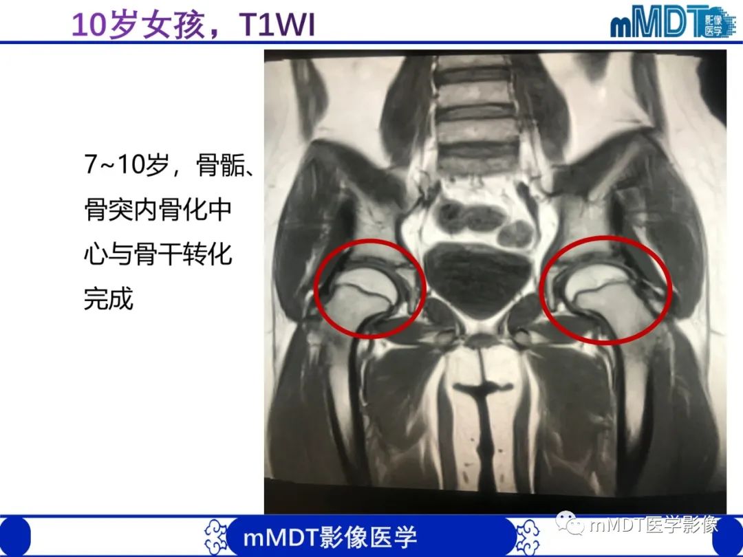 【PPT】骨髓的转化与逆转化