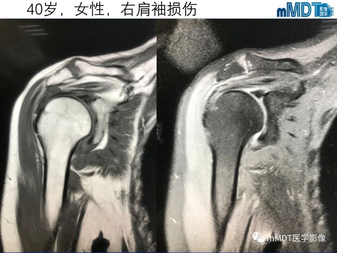 【PPT】骨髓的转化与逆转化