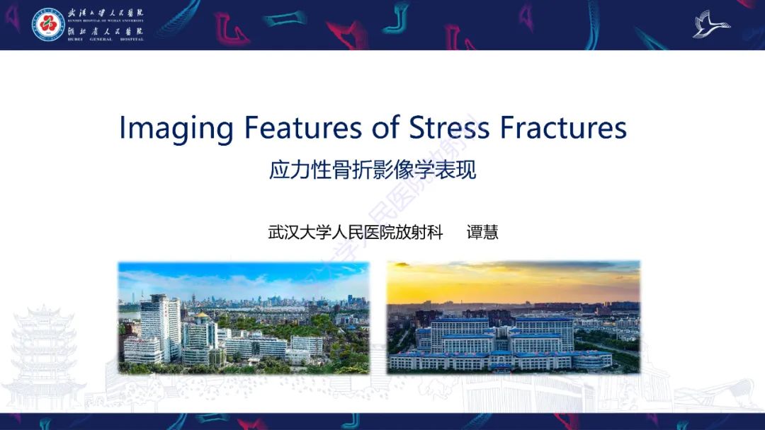 【PPT】应力性骨折影像学表现