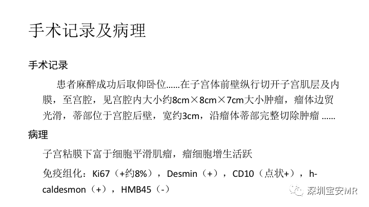 【PPT】子宫腔内病变MR