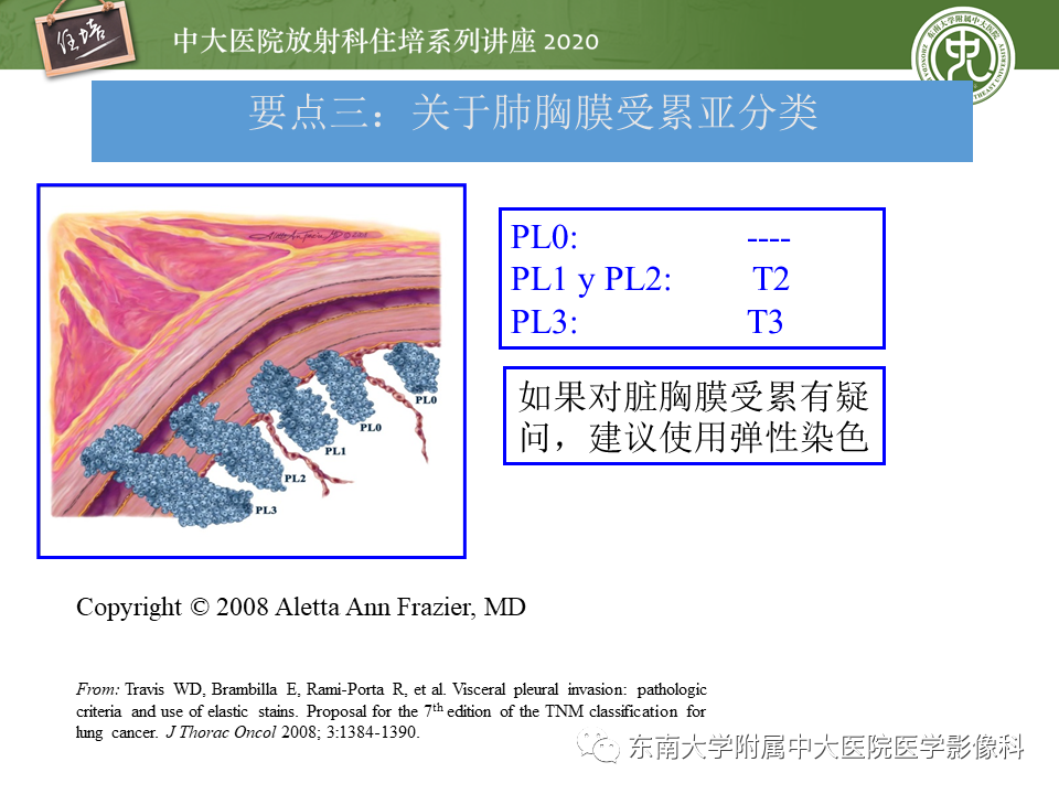 【PPT】肺癌TNM分期（UICC第8版）解读