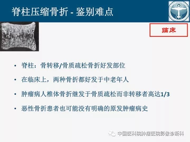 【PPT】椎体压缩骨折MRI鉴别诊断