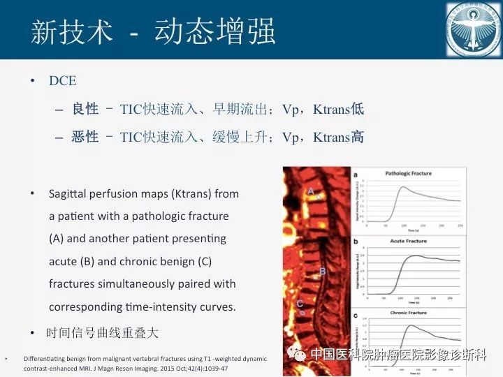 【PPT】椎体压缩骨折MRI鉴别诊断 【PPT】椎体压缩骨折MRI鉴别诊断