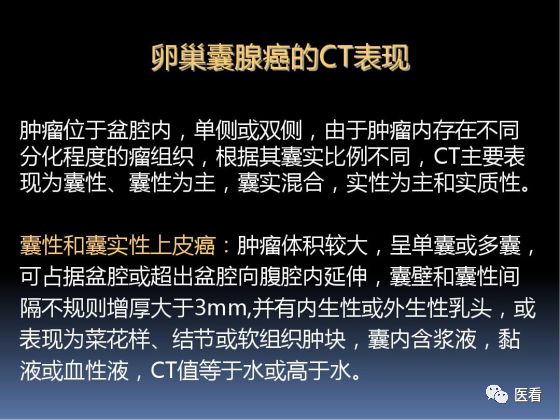 【PPT】卵巢恶性肿瘤的CT诊断